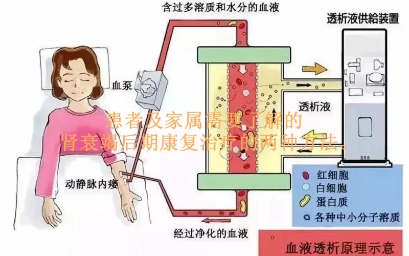 患者及家屬需要了解的腎衰竭后期康復(fù)治療的兩種方法