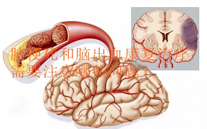 腦梗死和腦出血康復(fù)治療需要注意哪些問題？